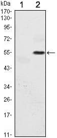 EIF2AK3 / PERK Antibody (clone 5G5)