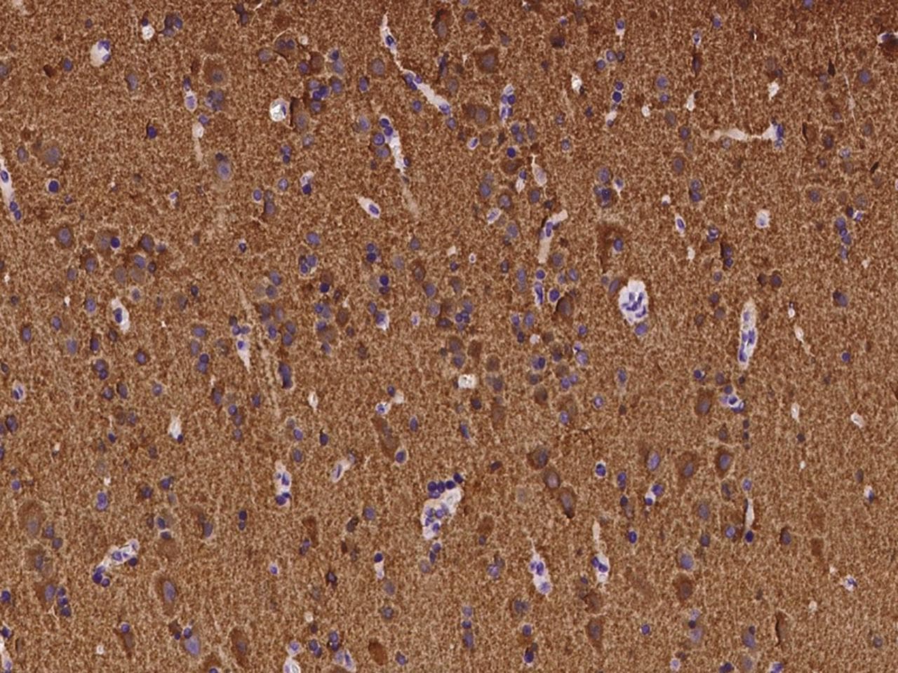 Polyclonal Rabbit anti-Human ATP6V1B2 Antibody (IHC, IF)