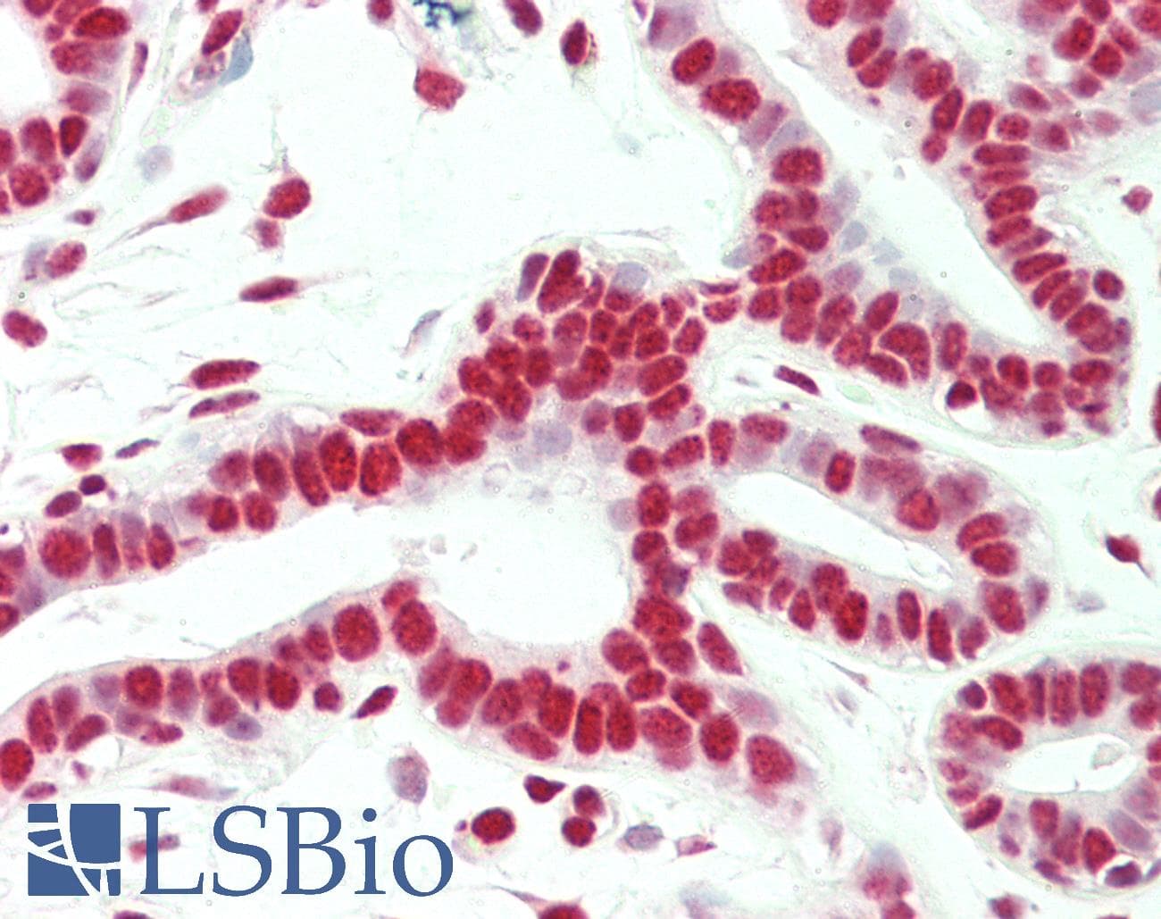 PathPlus™ SMC1A / SMC1 Antibody (aa1175-C-term)