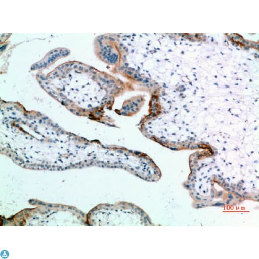 EDNRB / Endothelin B Receptor Antibody