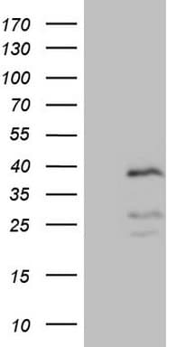 Monoclonal Mouse anti-Human DJ858B16.2 / PISD Antibody (clone OTI4G5, aa80-340, IHC, WB)