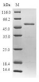Human SPIN2B Protein (Recombinant GST, N-terminus)