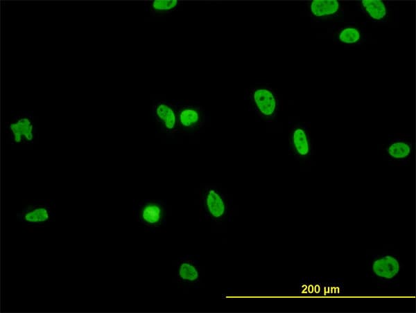 RBMXL2 Antibody (clone 6F11)
