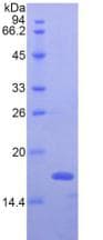 Rat IFN Gamma / Interferon Gamma Protein (Recombinant His, N-Terminal)