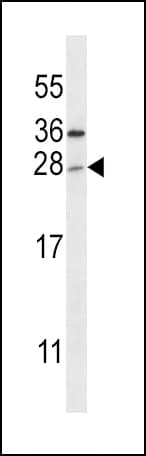 TICAM2 / TRAM Antibody (aa12-41)