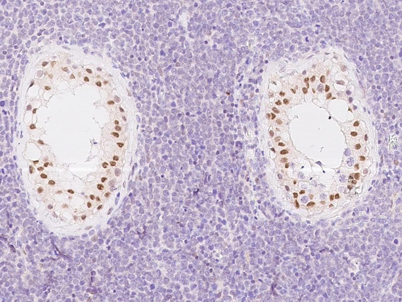 ATR Antibody