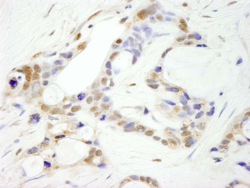 Polyclonal Rabbit anti-Human CPSF2 Antibody (aa450-500, IHC)