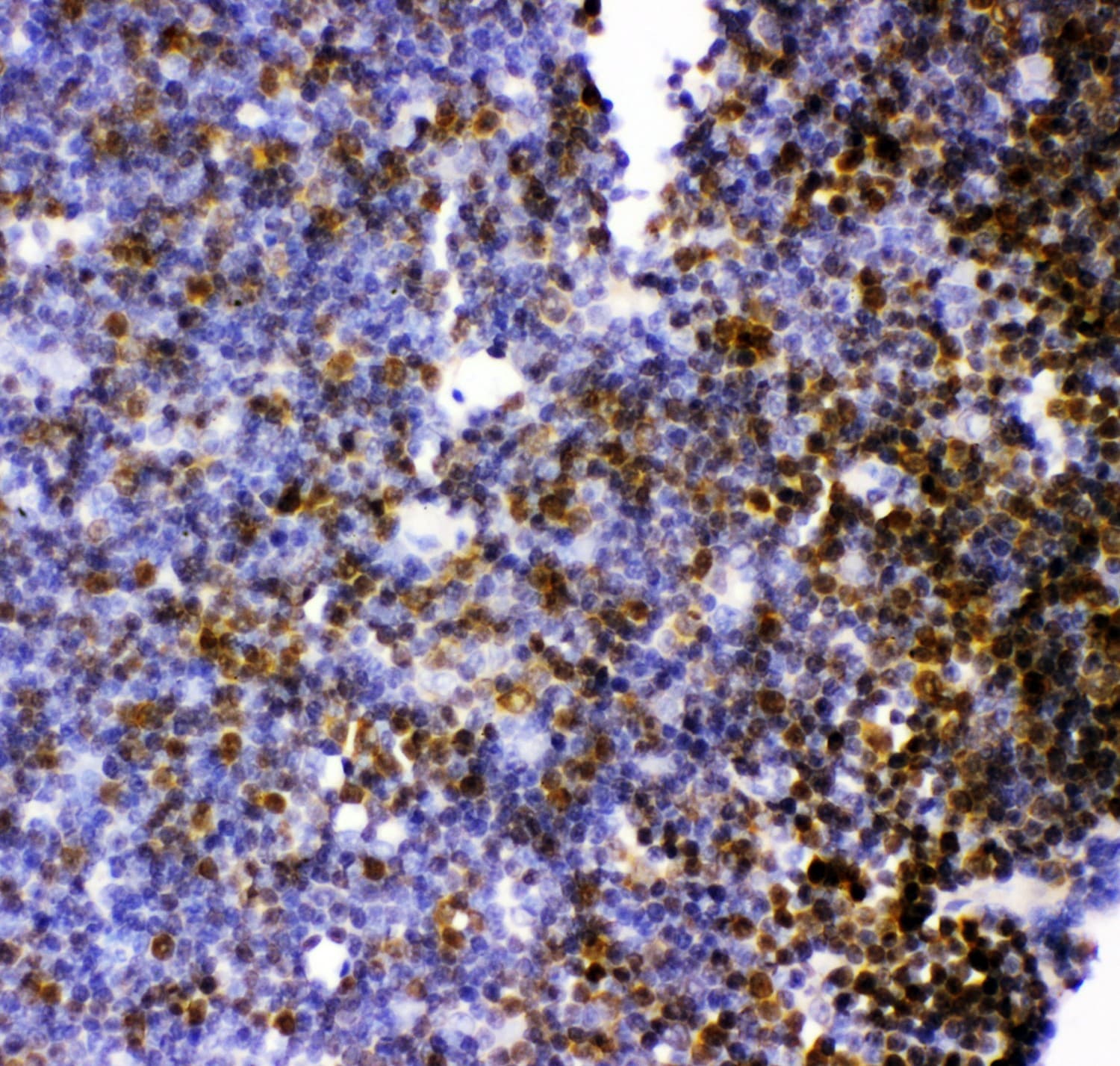 KIF2C / MCAK Antibody (aa531-725)