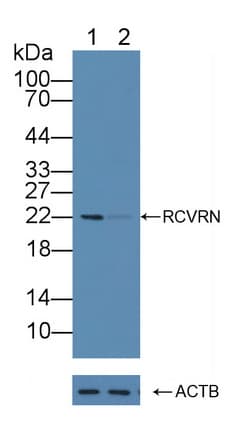 Recoverin Antibody (aa2-200)