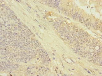 Polyclonal Rabbit anti-Human GRPEL2 Antibody (IHC)