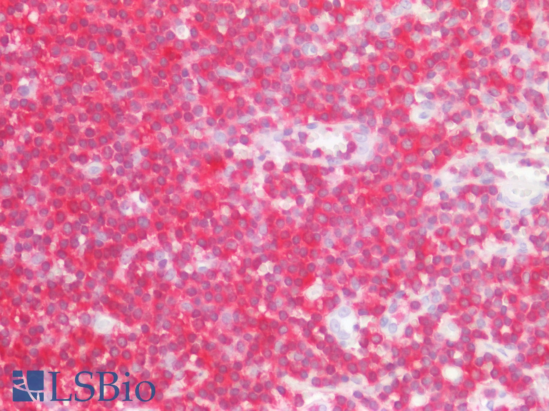 PathPlus™ LSP1 Antibody (aa445-459)