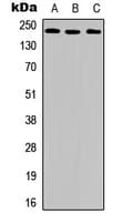 KDR / VEGFR2 / FLK1 Antibody (phospho-Tyr951)