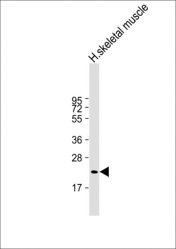 FNDC5 / Irisin Antibody (clone 1736CT532.85.53.92)