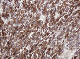 TBC1D13 Antibody (clone OTI2C5, Carrier-free)
