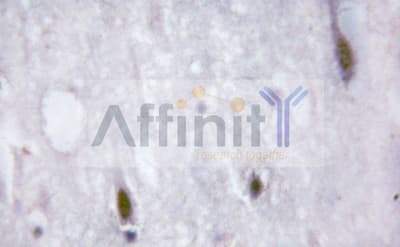CAMK4 / CaMK IV Antibody