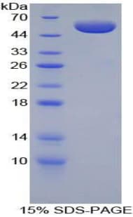 Mouse BOC Protein (Recombinant His-GST)