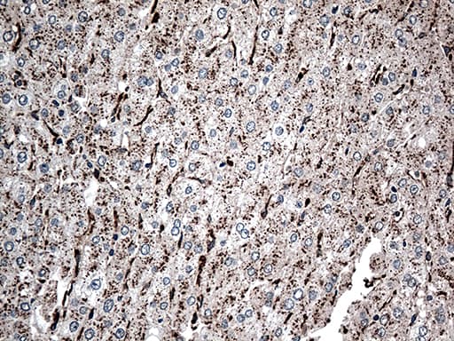 CTSL / Cathepsin L Antibody (aa114-333, clone OTI5C8)