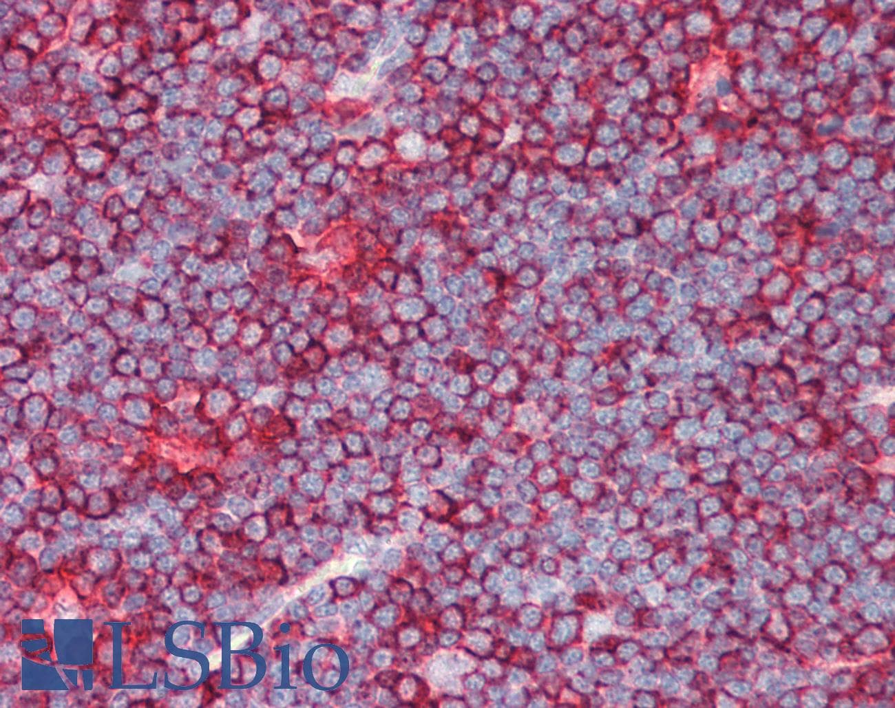 PathPlus™ TUBB / Beta Tubulin Antibody