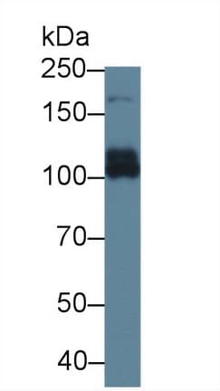 ABCC6 / MRP6 Antibody
