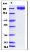 Human KDR / VEGFR2 / FLK1 Protein (Recombinant His,C-terminus)