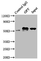 GPT / Alanine Transaminase Antibody (aa2-496)