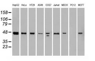 SSB / La Antibody (clone OTI2C8)