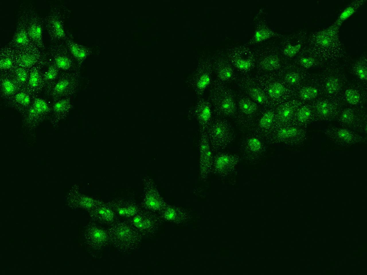 UTP18 Antibody