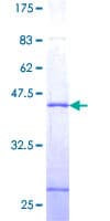 Human SSNA1 Protein (Recombinant GST)