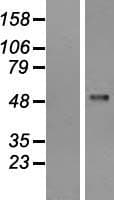 PFKFB1 Protein (Over-Expression Lysate Myc-DDK (Flag))