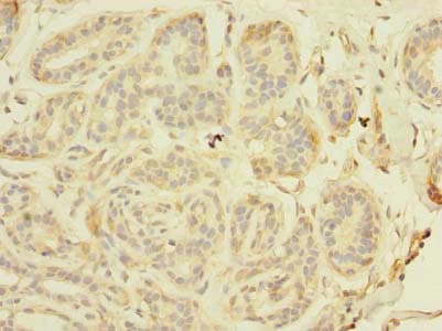 Polyclonal Rabbit anti-Human TAGAP Antibody (IHC)