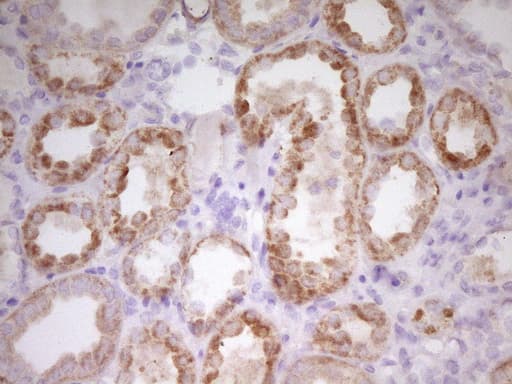 Monoclonal Mouse anti-Human PAPSS2 Antibody (clone OTI3H10, aa1-247, IHC, WB)