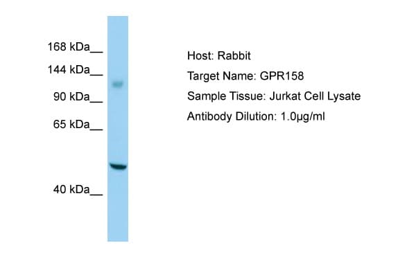 Polyclonal Rabbit anti-Human GPR158 Antibody (aa1120-1169, WB)