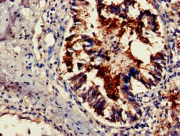 Polyclonal Rabbit anti-Human TSR2 Antibody (IHC, IF, WB)