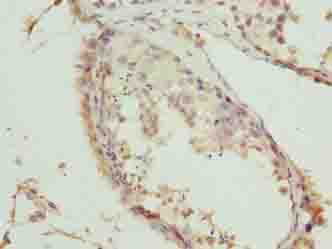 Polyclonal Rabbit anti-Human TRM6 / TRMT6 Antibody (IHC, WB)