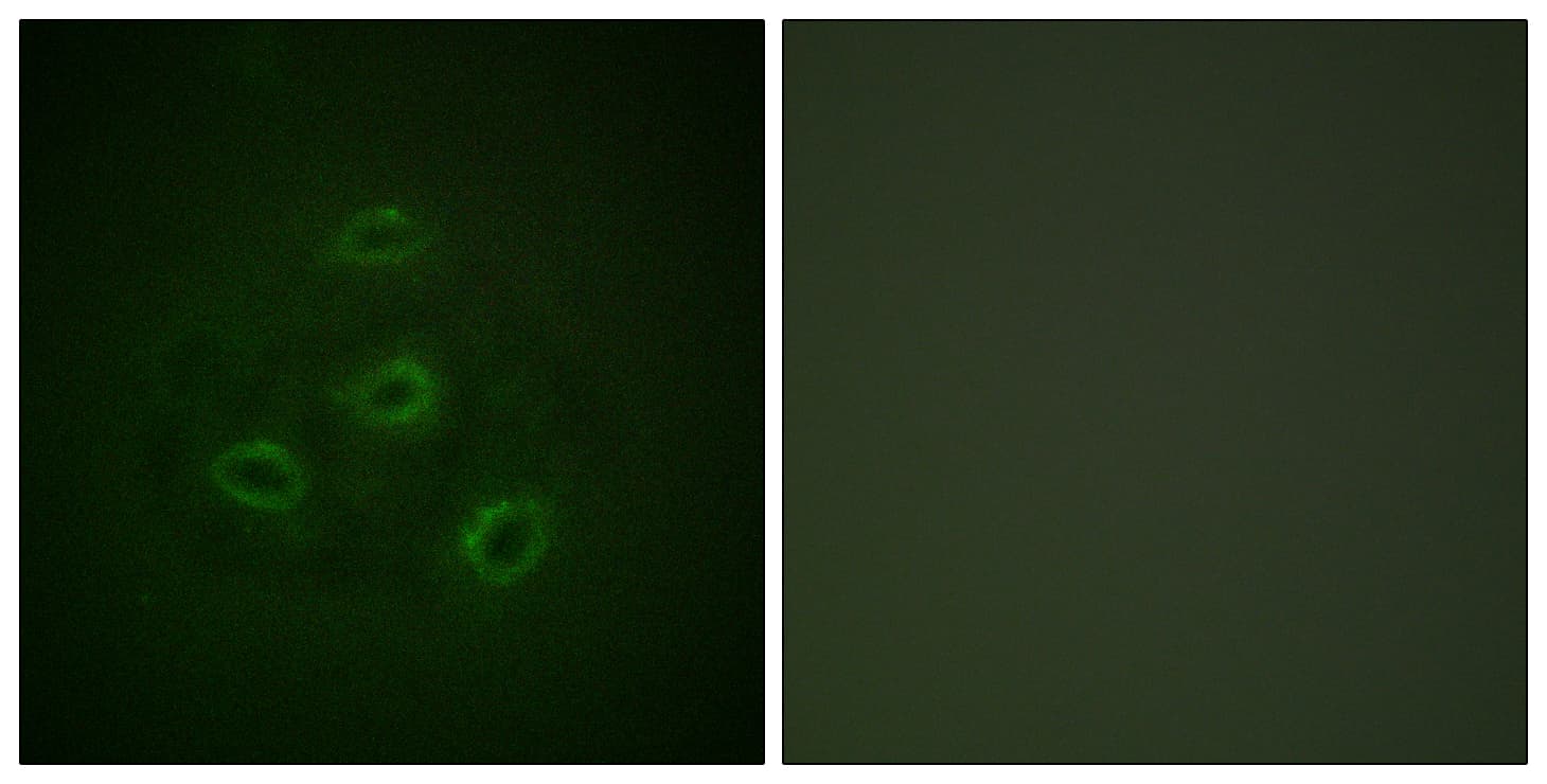Polyclonal Rabbit anti-Human PP2Ac / PPP2CA Antibody (aa260-309, IHC, IF, WB)