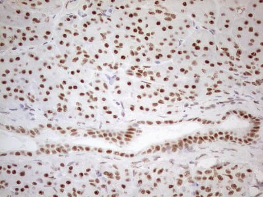 Monoclonal Mouse anti-Human WTAP Antibody (clone OTI12G7, aa2-106, IHC, WB)