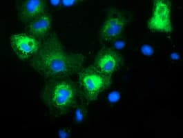 MAPK7 / ERK5 Antibody (clone OTI5B9)