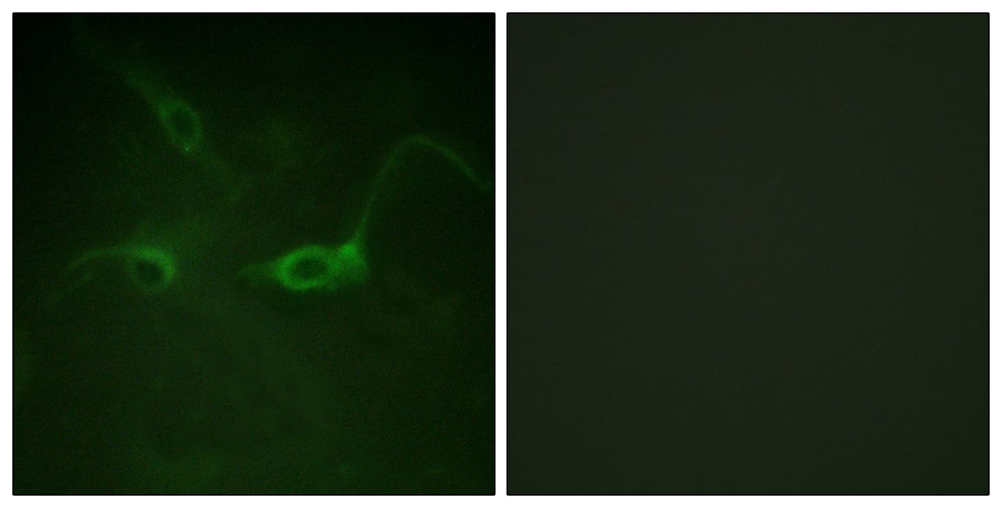 FGFR1 / FGF Receptor 1 Antibody (phospho-Tyr654)
