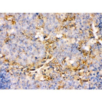 Polyclonal Rabbit anti-Human TNFRSF4 / CD134 / OX40 Antibody (aa232-254, IHC, WB)