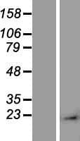 AMACR / P504S Protein (Over-Expression Lysate Myc-DDK (Flag))