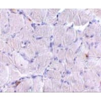 Polyclonal Rabbit anti-Human LIMPII / SCARB2 Antibody (IHC, WB)