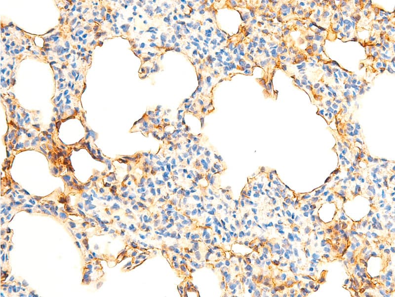 Polyclonal Rabbit anti-Human NFKBIA / IKB Alpha / IKBA Antibody (phospho-Ser32,phospho-Ser36, IHC, IF, WB)