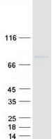Human HMMR / CD168 / RHAMM Protein (Recombinant Myc-DDK (Flag))