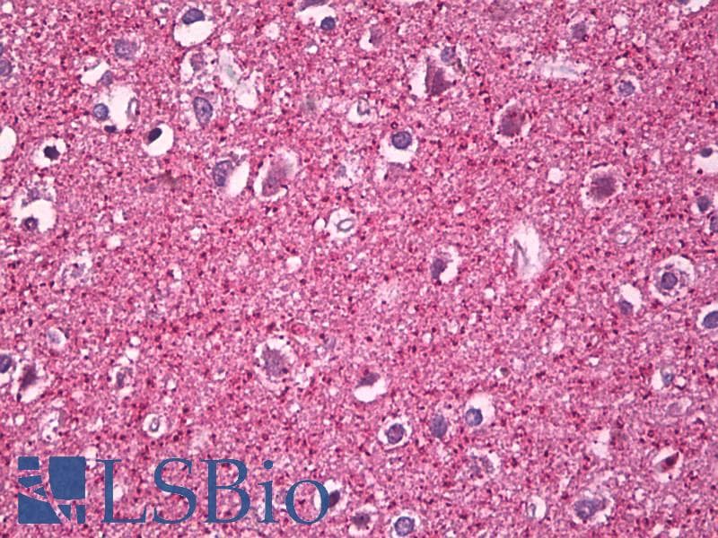 IHC-plus™ MZF / MZF1 Antibody (aa1-50)
