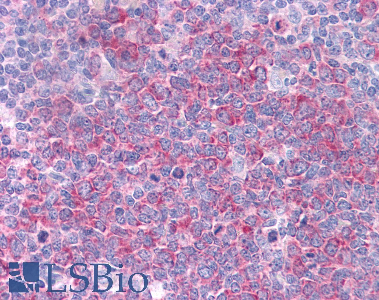 HSP90AA1 / Hsp90 Alpha A1 Antibody (aa108-157)