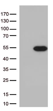 Monoclonal Mouse anti-Human PDX1 Antibody (clone OTI4H7, WB)