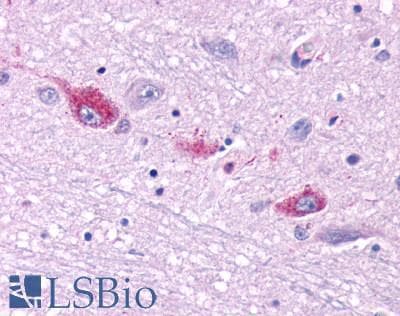 PathPlus™ Polyclonal Rabbit anti-Human CASR/Calcium Sensing Receptor Antibody (N-Terminus, IHC)