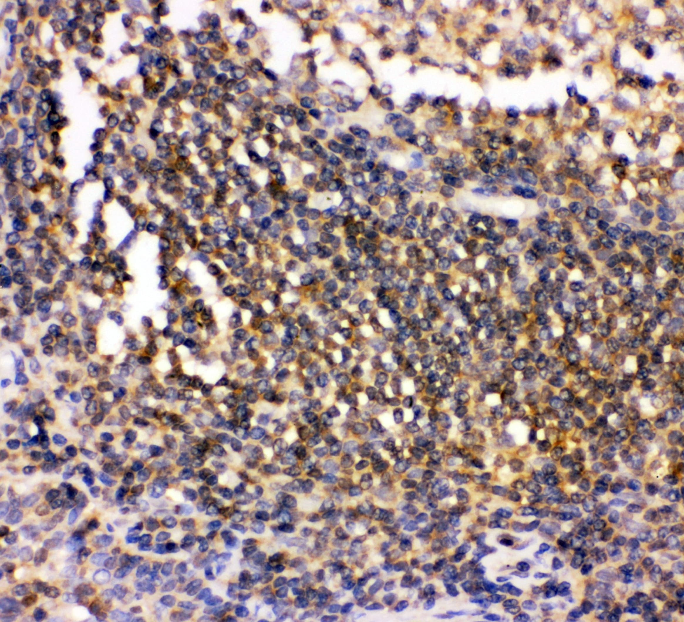 Polyclonal Rabbit anti-Human c-Src Kinase / CSK Antibody (aa2-204, IHC, WB)