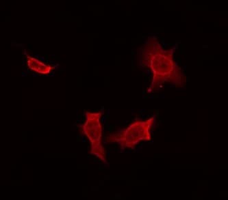 Polyclonal Rabbit anti-Human MOB3A / MOBKL2A Antibody (IF, WB)