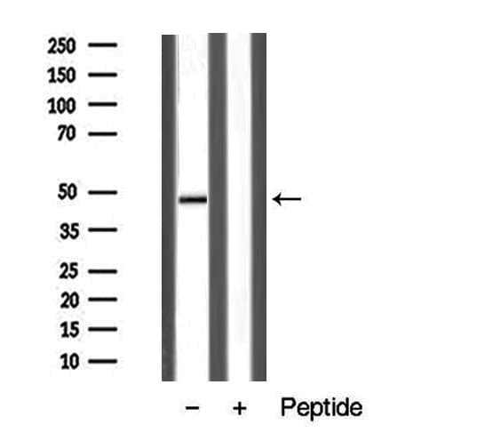 Polyclonal Rabbit anti-Human AVPR1B Antibody (IF, WB)
